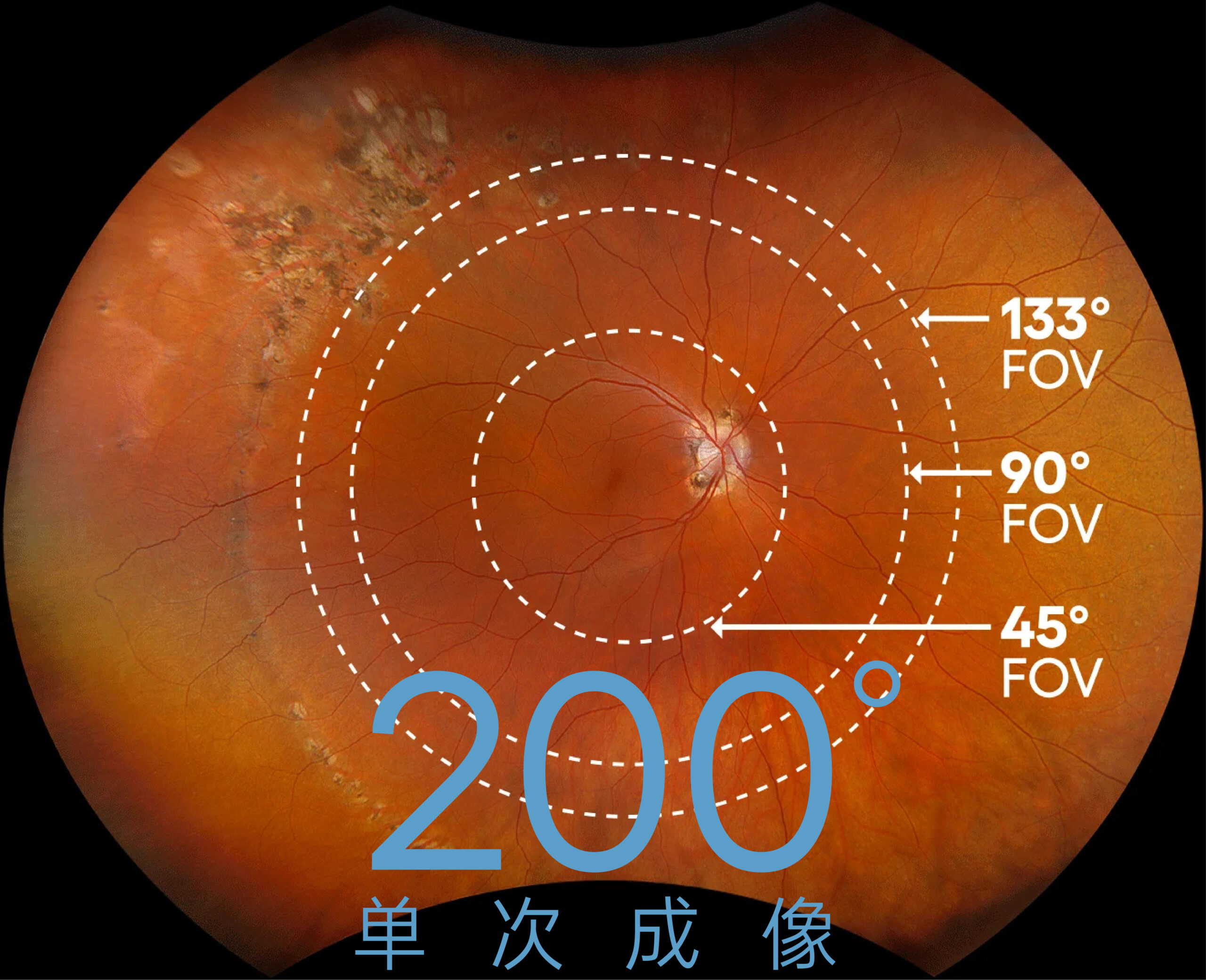 贝斯特bst(中国区)-官方网站